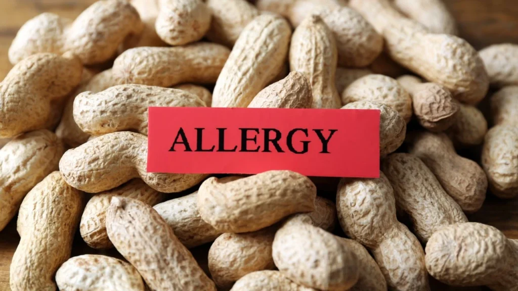 Peanuts with a red "allergy" sign highlighting potential allergens.